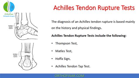 achilles tendon tear special test|special test for achilles tear.